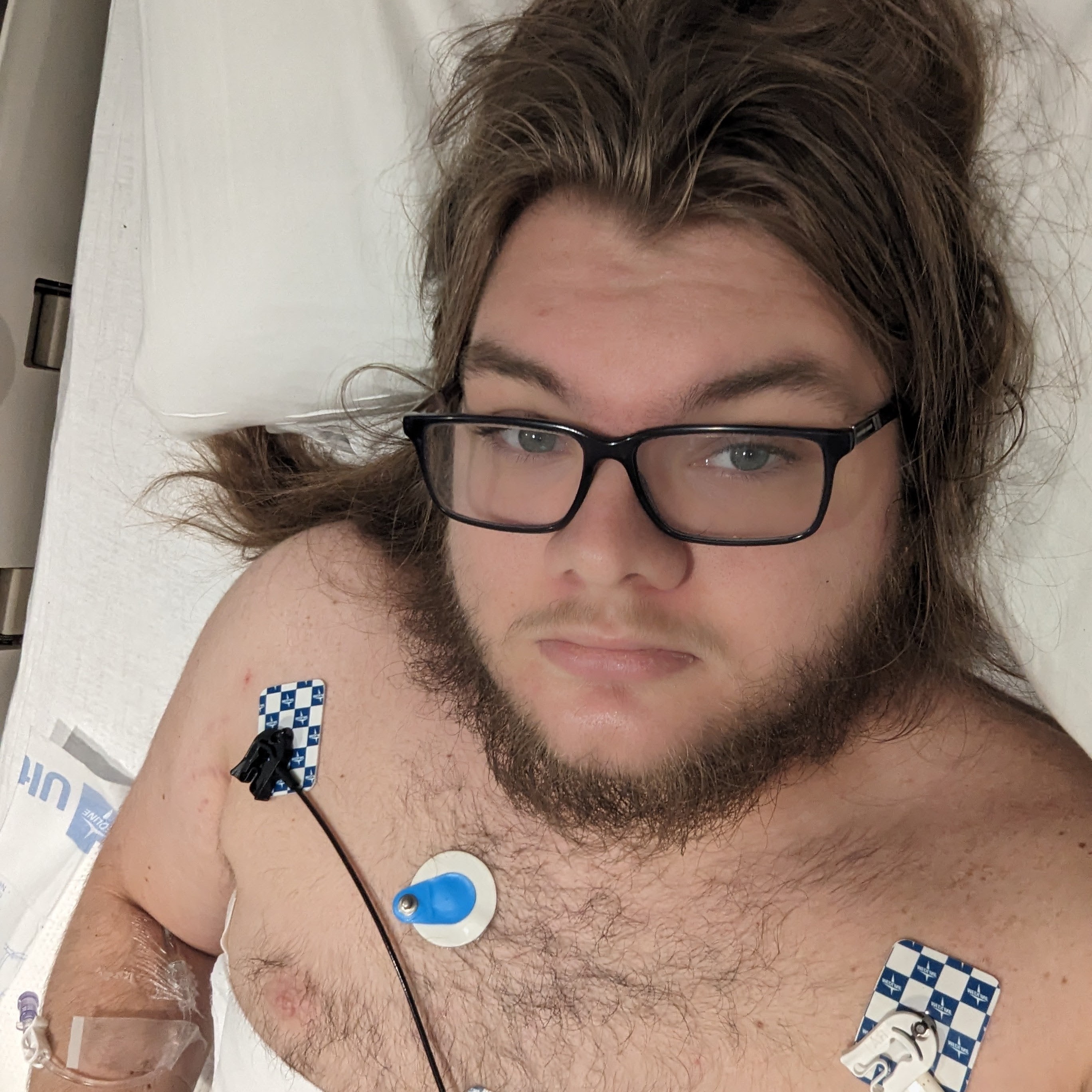 Me laying in a hospital bed with a heart monitor and iv